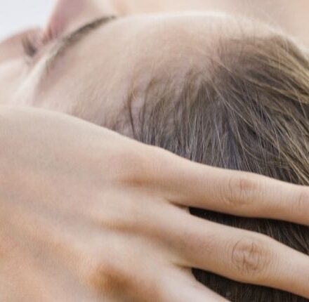 Itchy scalp: a good regime to adopt