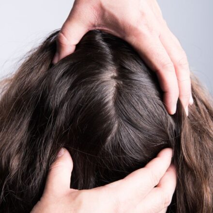 Dry scalp: consequences and solutions