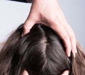 Dry scalp: consequences and solutions