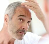 Guys: How to prevent hair loss